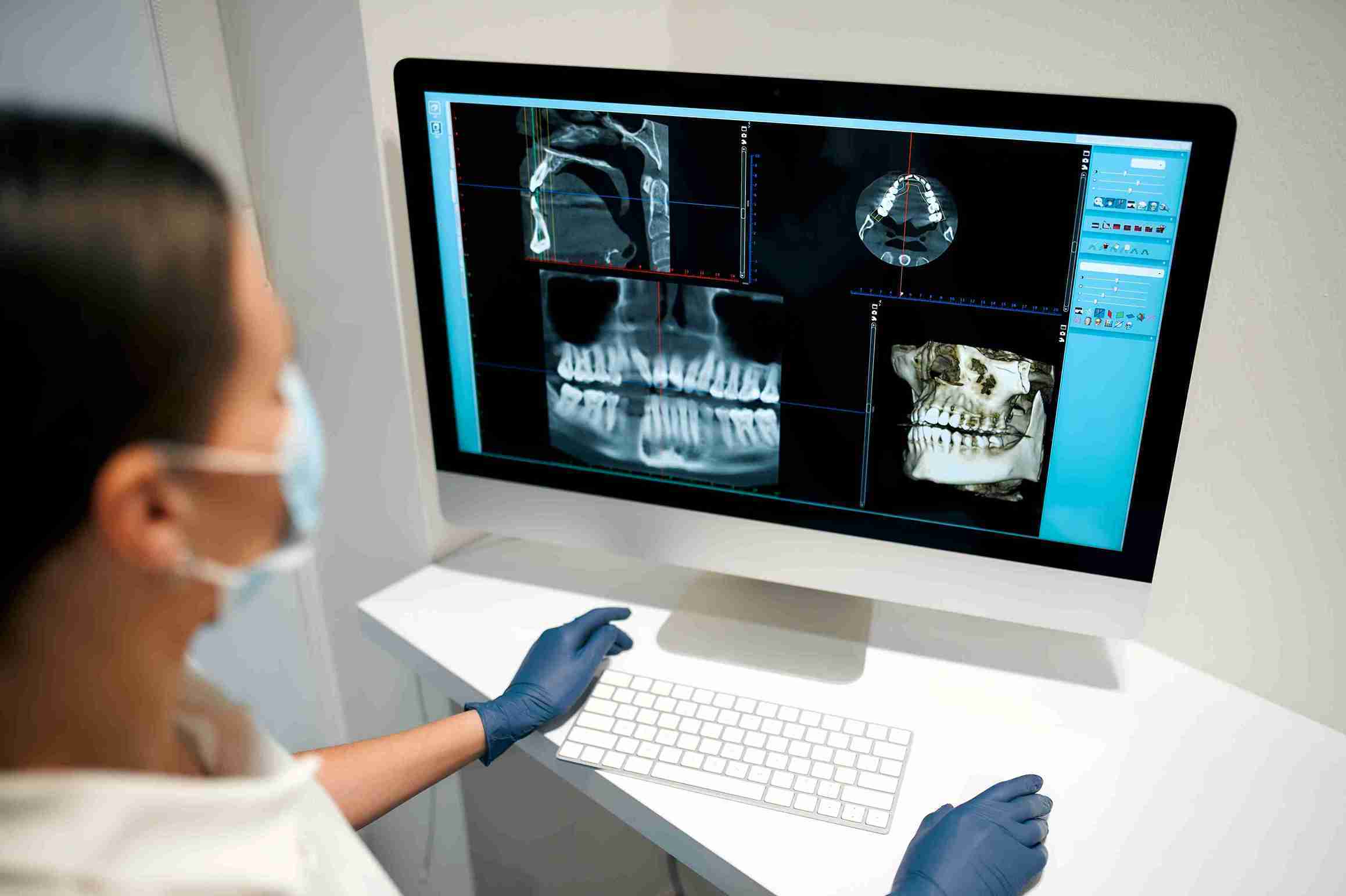Tomografia dental come beam 3D 