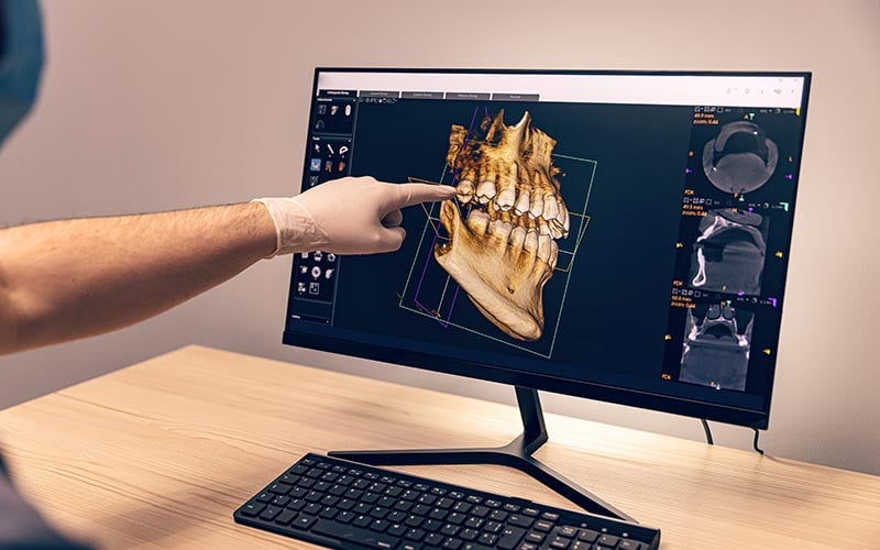 cad-cam-odontologia