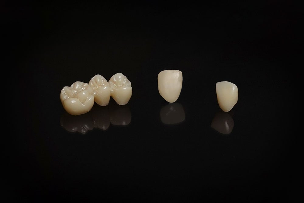 cementacion-zirconia