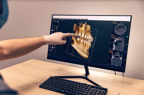 innovaciones-tecnologicas-2023-ortodoncia-3