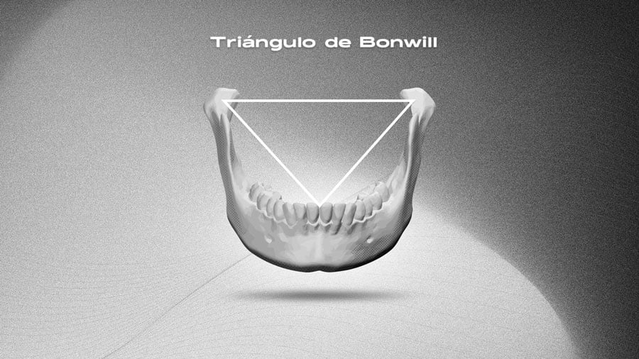 triangulo-bonwill