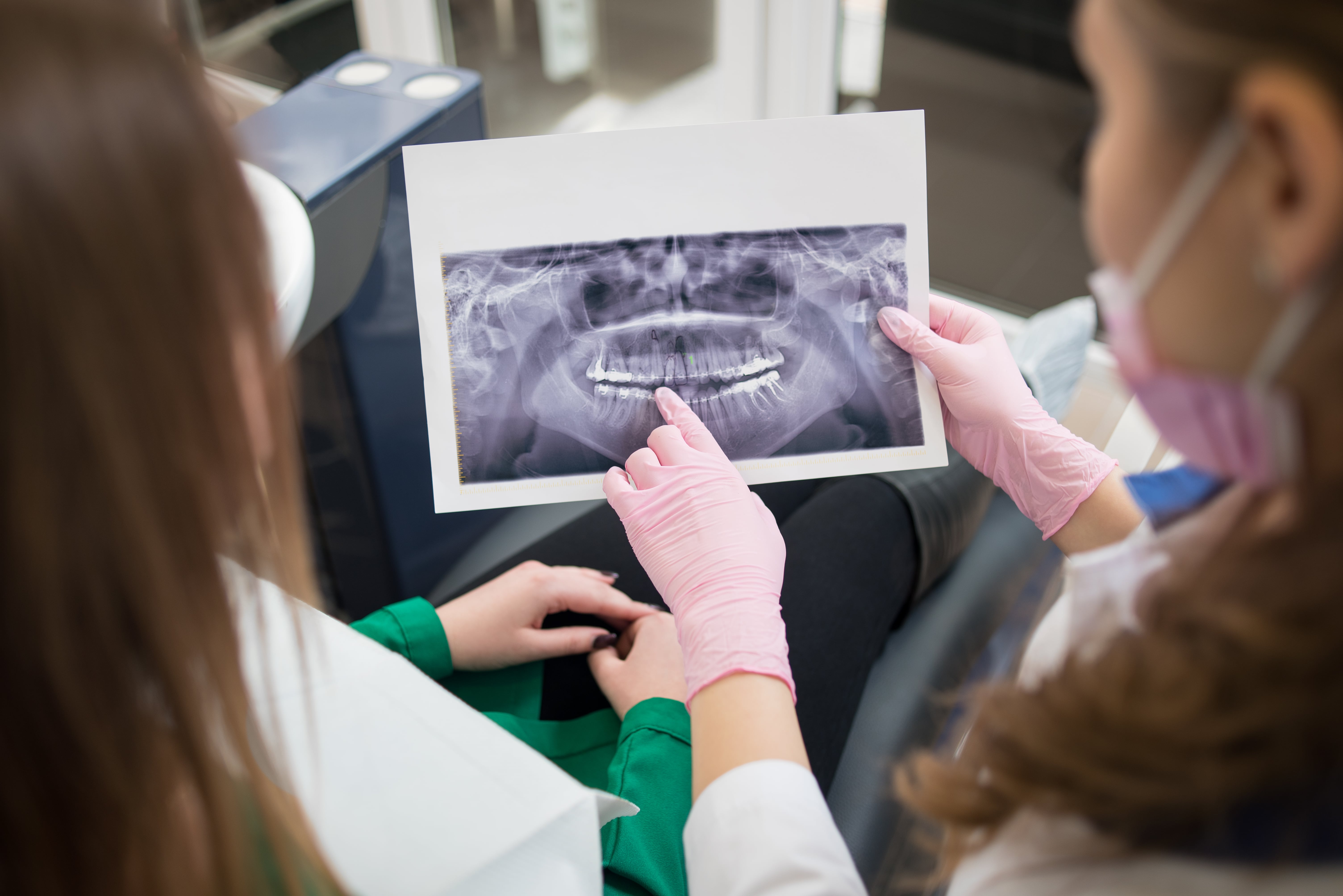 Tratamiento de ortodoncia en pacientes con raíces cortas