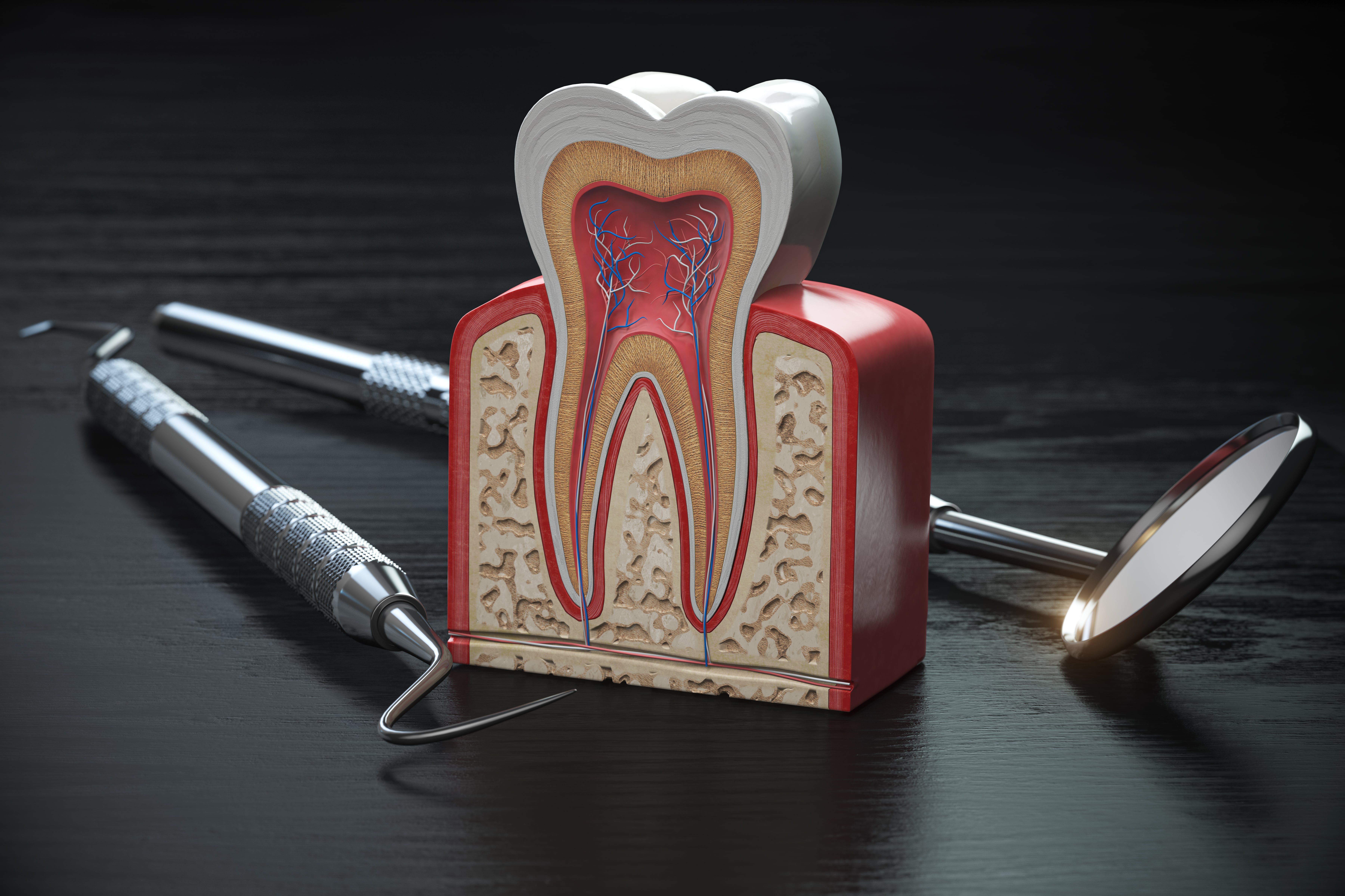 Ortodoncia en pacientes con Periodontitis, ¿es posible?