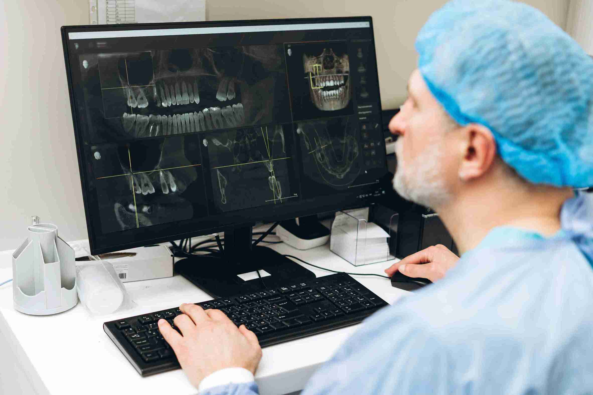 CBCT dental: Qué es y por qué es superior a las radiografías comunes
