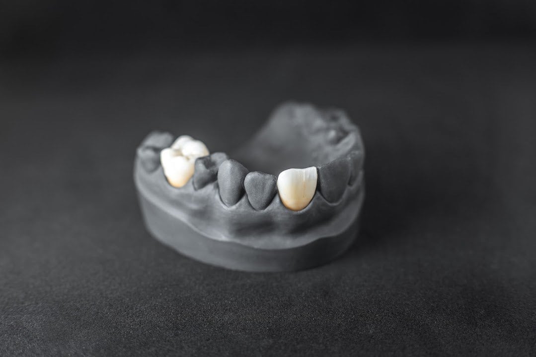 Prótesis dental sobre fondo gris