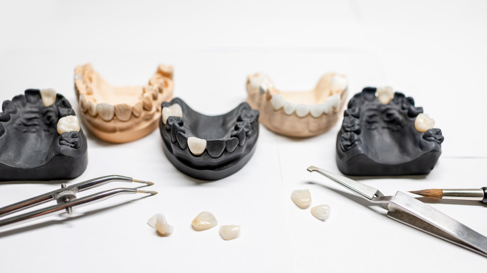 Descubre los materiales para hacer una prótesis dental