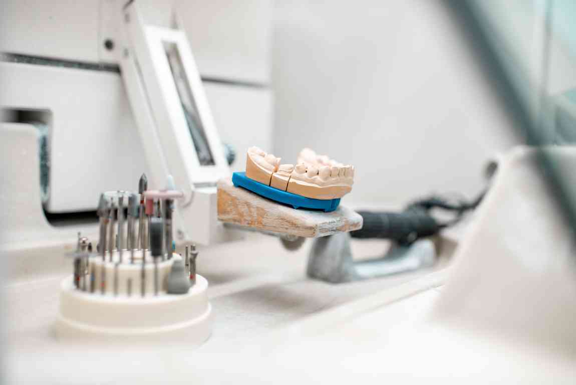 Montado de modelos en articulador dental: Guía paso a paso