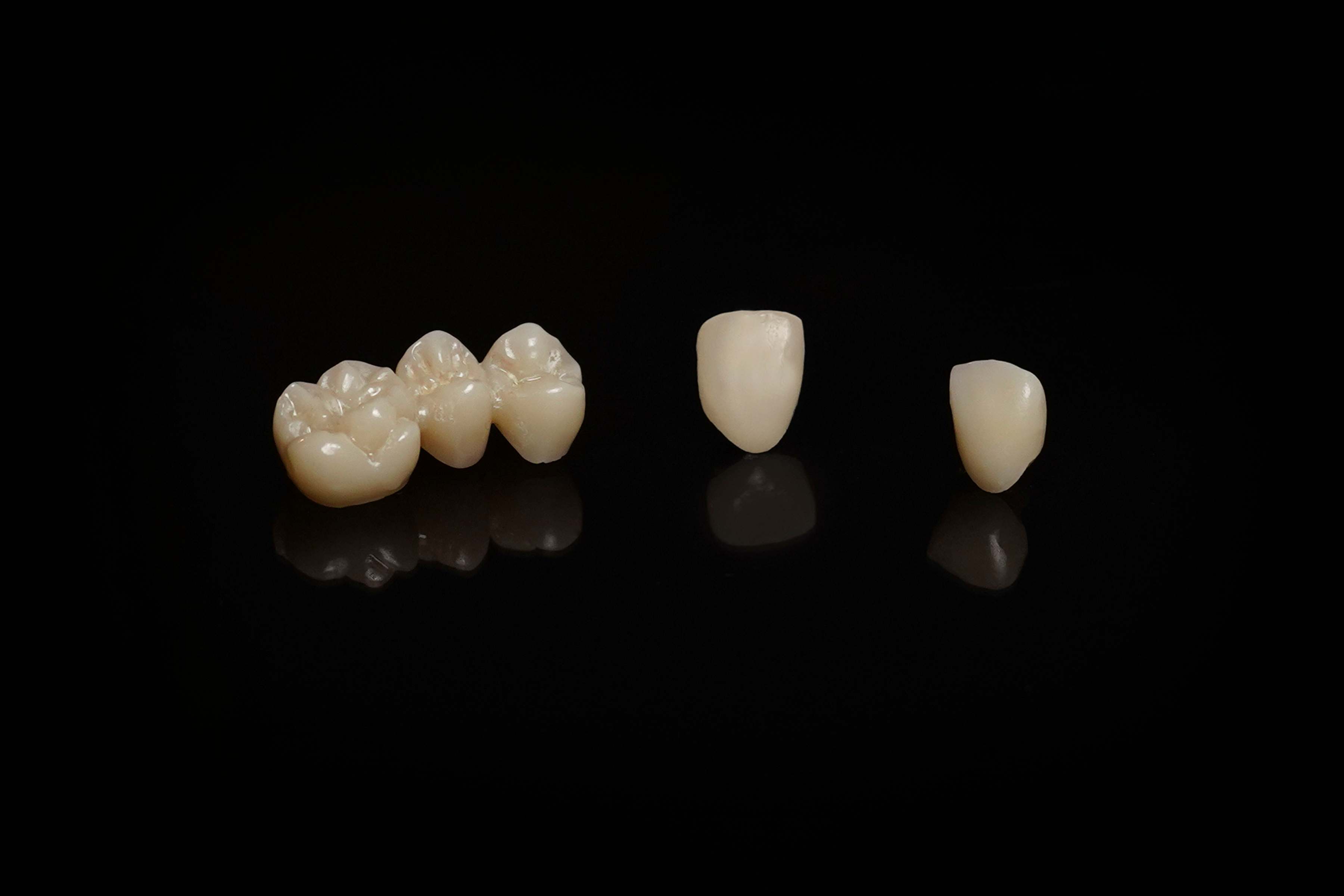 ¿Qué es la sinterización dental y por qué es vital en la prótesis fija?